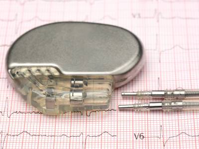 Širdies stimuliatorius ir implantuojamasis kardioverteris defibriliatorius